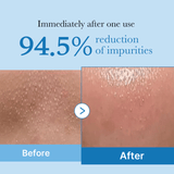 MEDICUBE Zero Pore Blackhead Deep Cleansing Oil